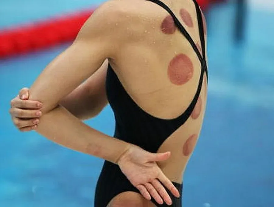 Вендузите - хит на Олимпиадата