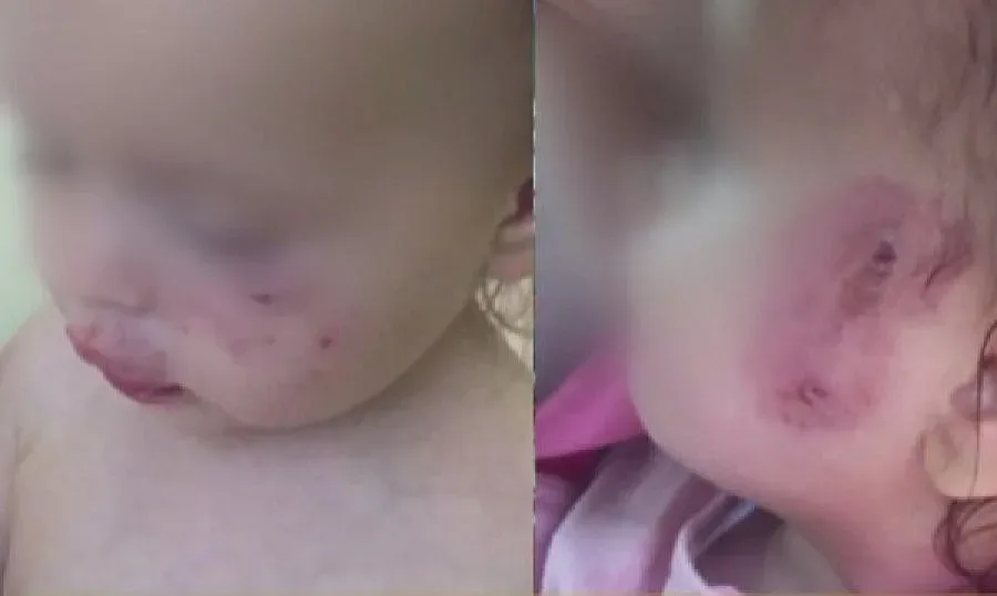 Хайки в забавачките заради нахапано хлапе (ОБЗОР)