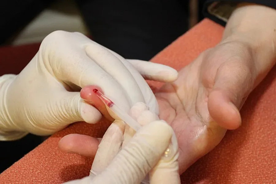 110 хил. българи поразени от тихия убиец Хепатит С