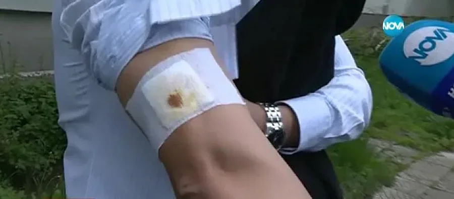 Ротвайлер нападна баща и дете