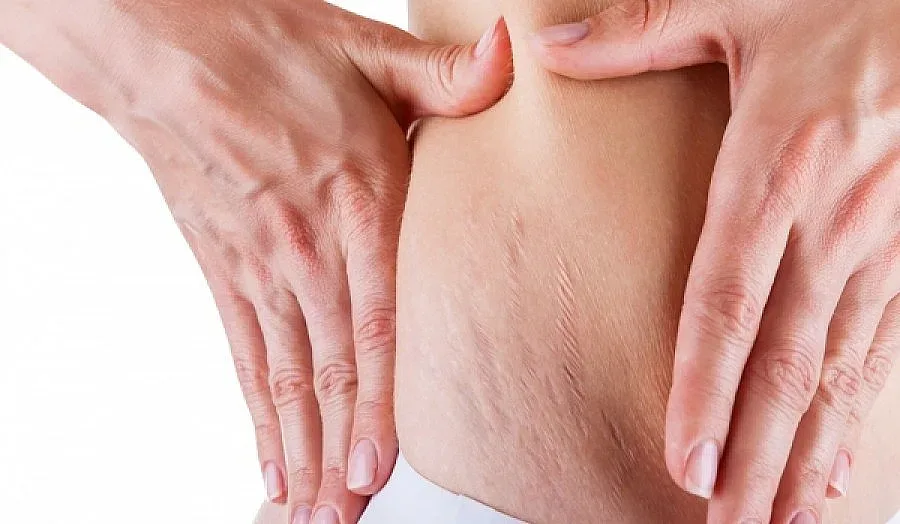 Водата бори стриите