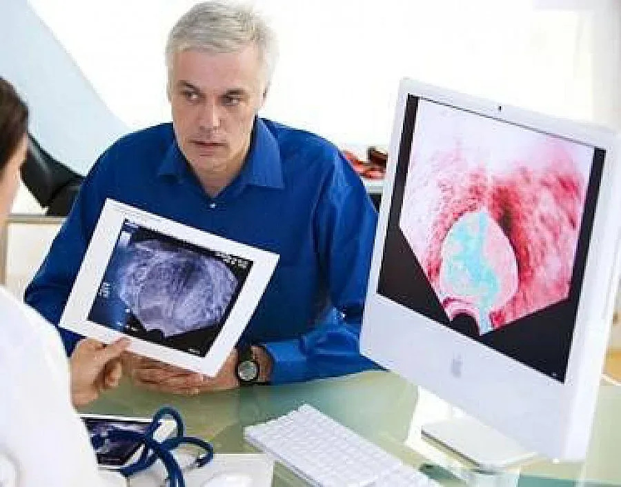 Лазерната простатна хирургия от Лейзър Мед