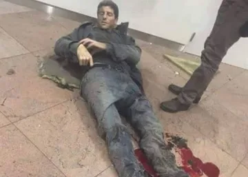 Баскетболист с две операции след взрива на летището