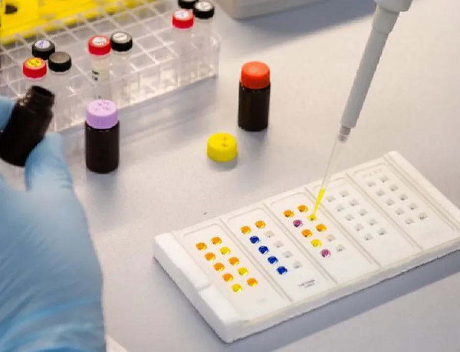 Учени: Има връзка между Зика и микроцефалията