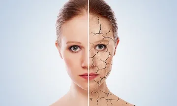 Студът дълбае бръчки по лицето