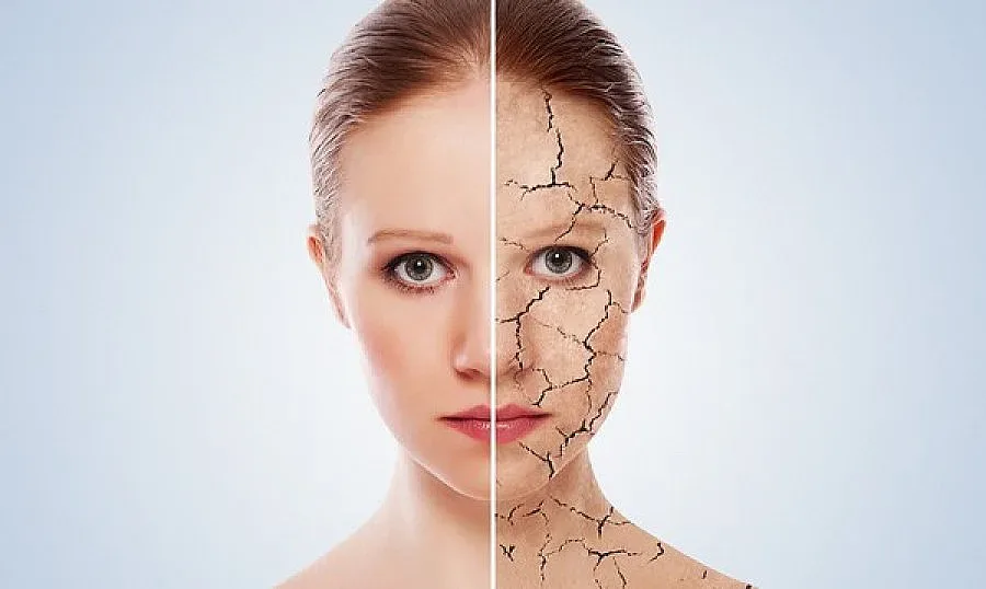 Студът дълбае бръчки по лицето