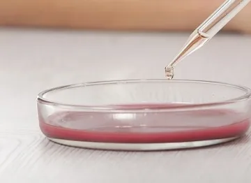 Случай на туларемия в Пловдив