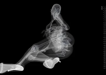 Сдобиваме се с рентгенови очи за 250 долара