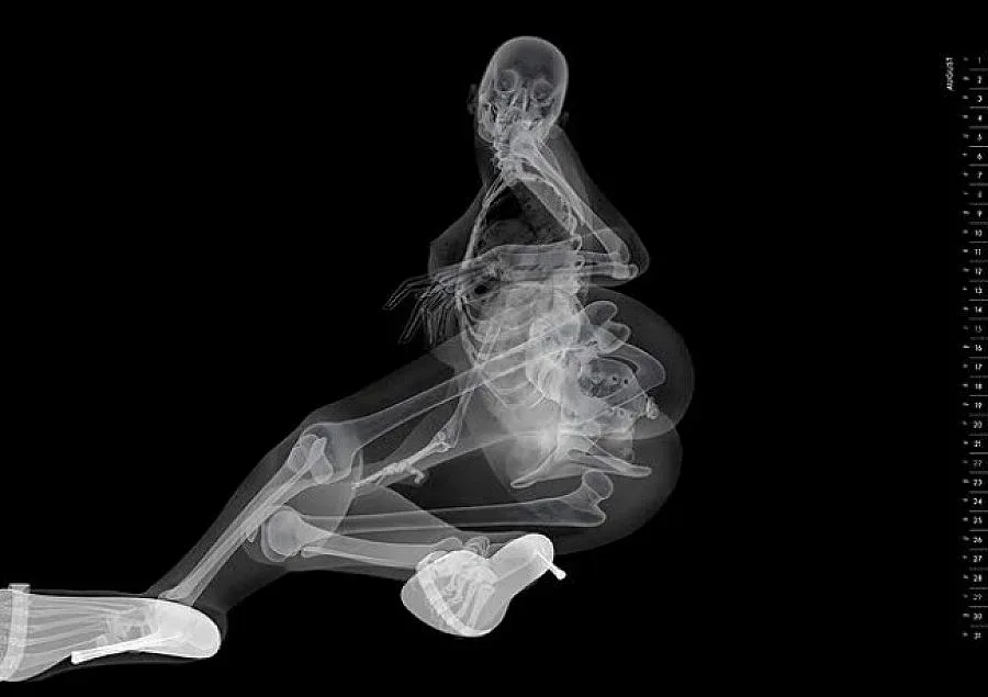 Сдобиваме се с рентгенови очи за 250 долара