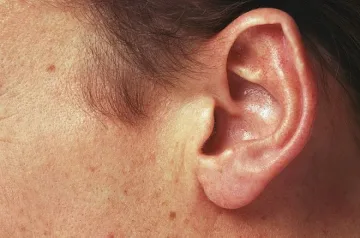 Украински депутати се сбиха, единият остана без ухо