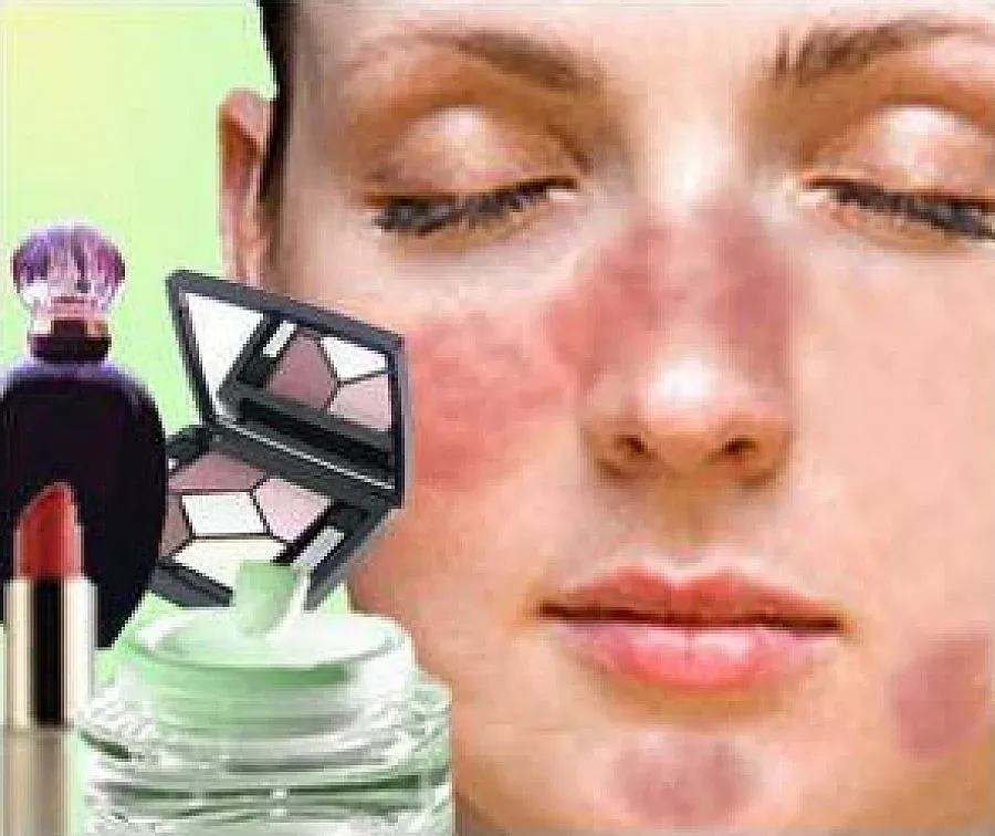 GSM, памперси и грим отключват алергии