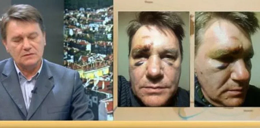 Жесток полицейски побой над преподавател