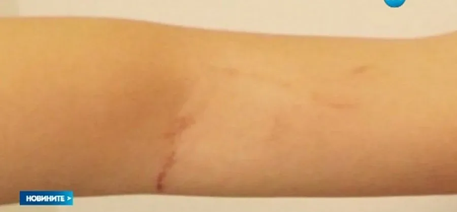 Дете отказа кашкавал в забавачка, учителката го раздра