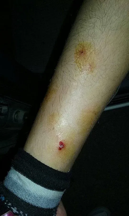 Доберман нахапа две деца в Харманли