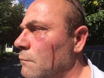 Роми нападнаха и пребиха репортери на Нова в Самоков