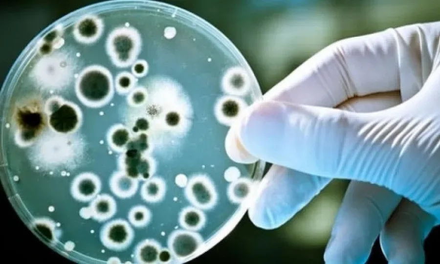 Огнище на антракс в село Еленово