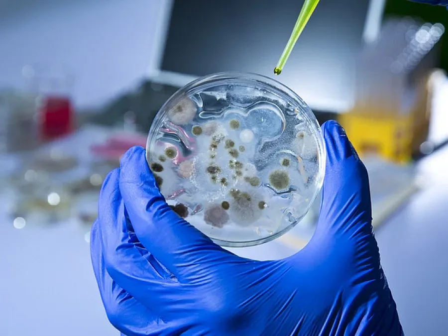 Антракс умори и бик от Млада гвардия