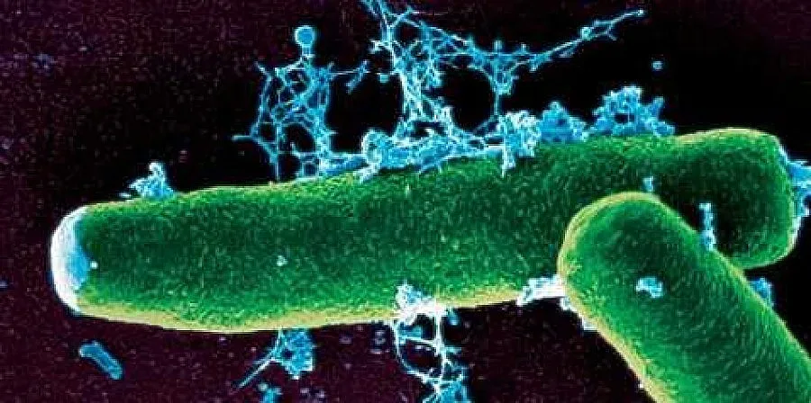 Откриха тримата, издирвани заради заразеното с антракс месо