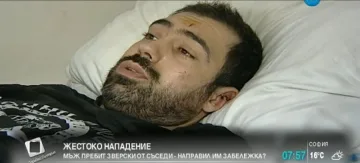 Съседи пребиха зверски столичанин в жилищен блок