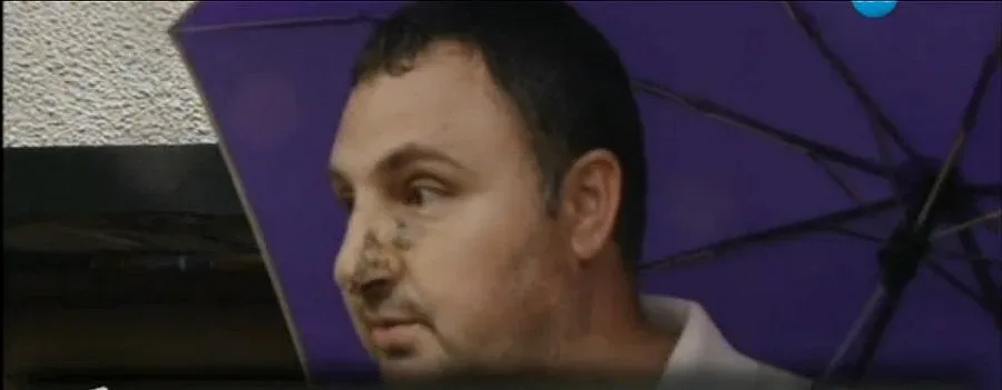 Брацигово с подписка  срещу питбула, обезобразил човек