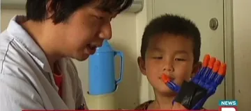 Подариха 3D протеза на дете за 1 юни