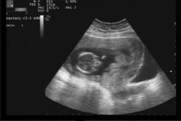 Гери от "Женените" е бременна