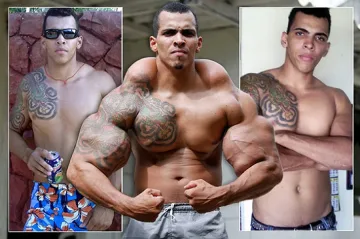 Фен на Хълк на косъм от ампутация на ръцете