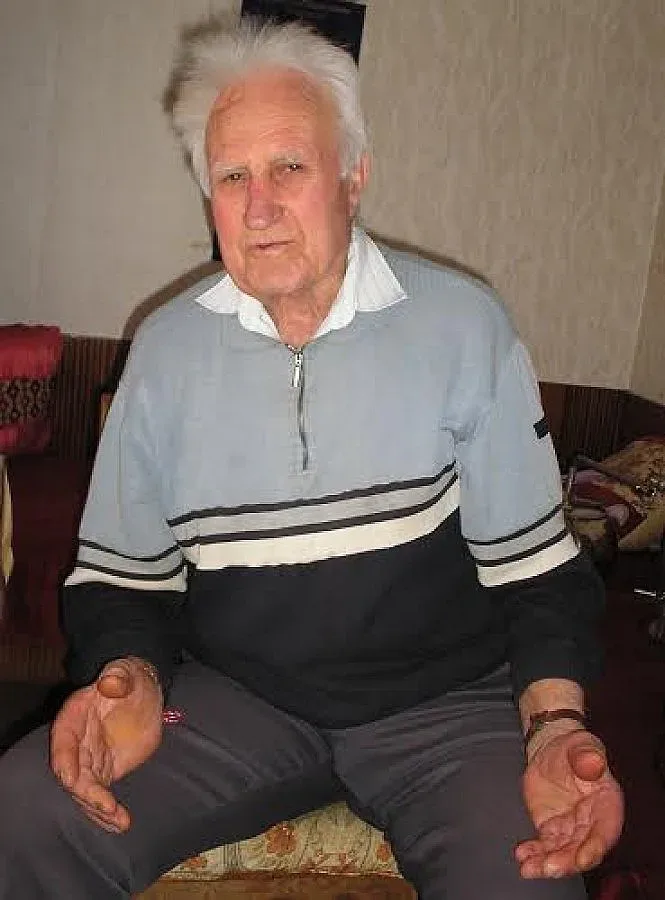  Масаж на петите е лек за всяка болка