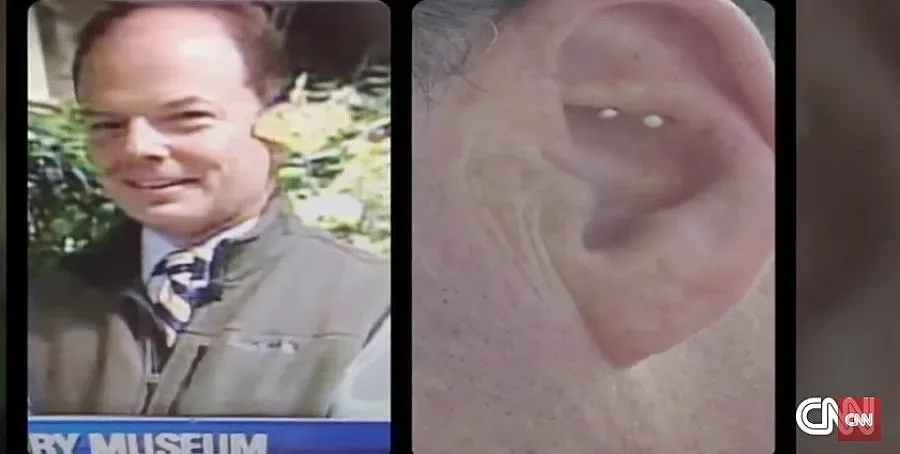 Пеперуда снесе яйца в ухото на репортер (ВИДЕО)