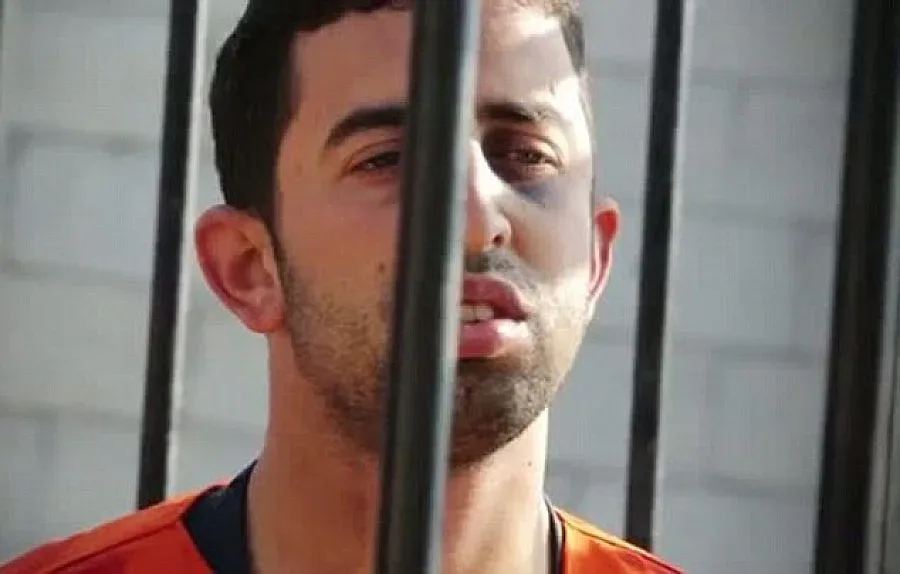 Джихадистите дрогирали изгорения пилот