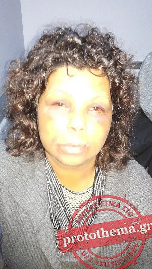 СИРИЗА застана зад пребитата българка