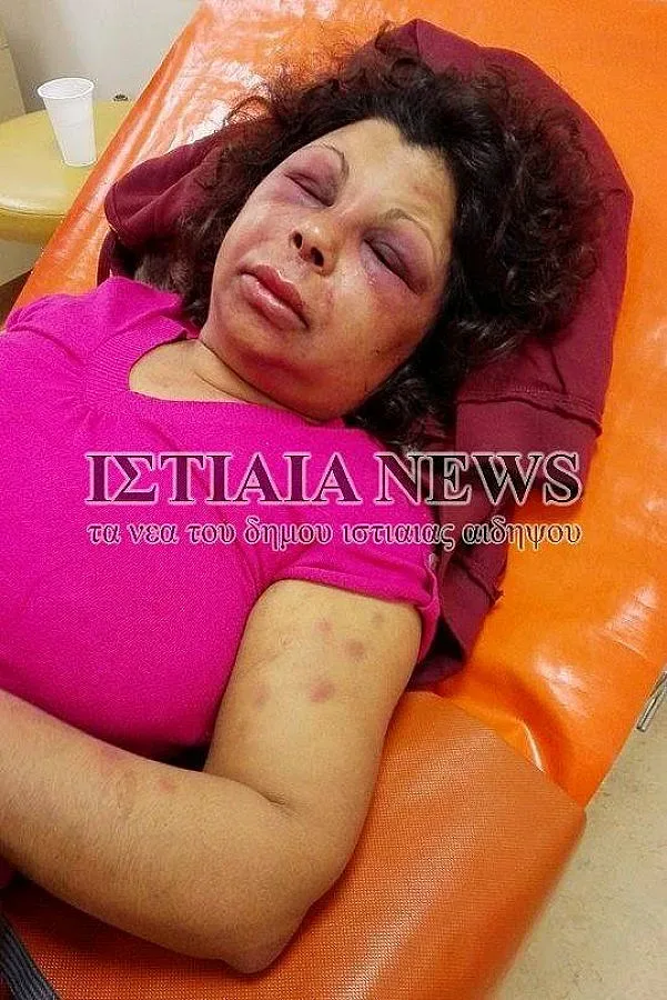 Изтезаваха наша прислужница в Гърция