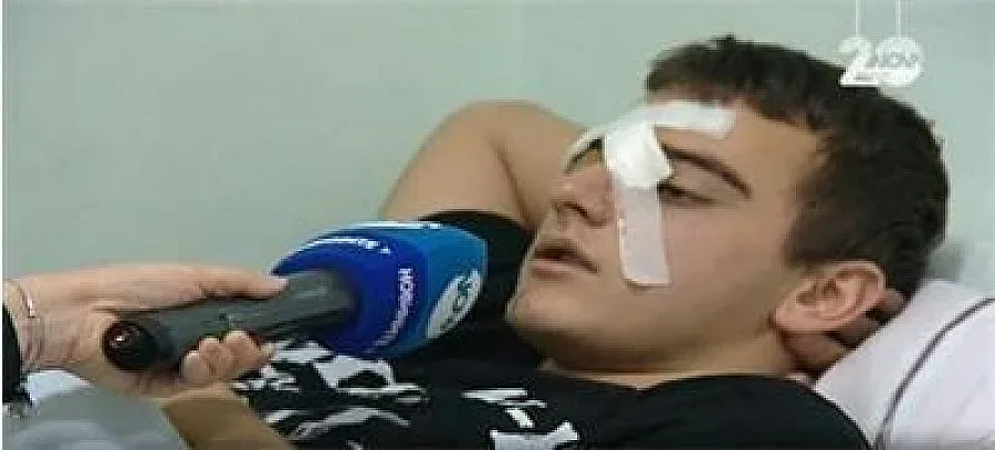 Изписаха от болницата момчето, пребито от футболни фенове