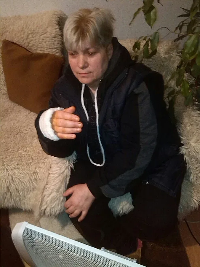 Пребитата санитарка в Благоевград подаде жалба в полицията