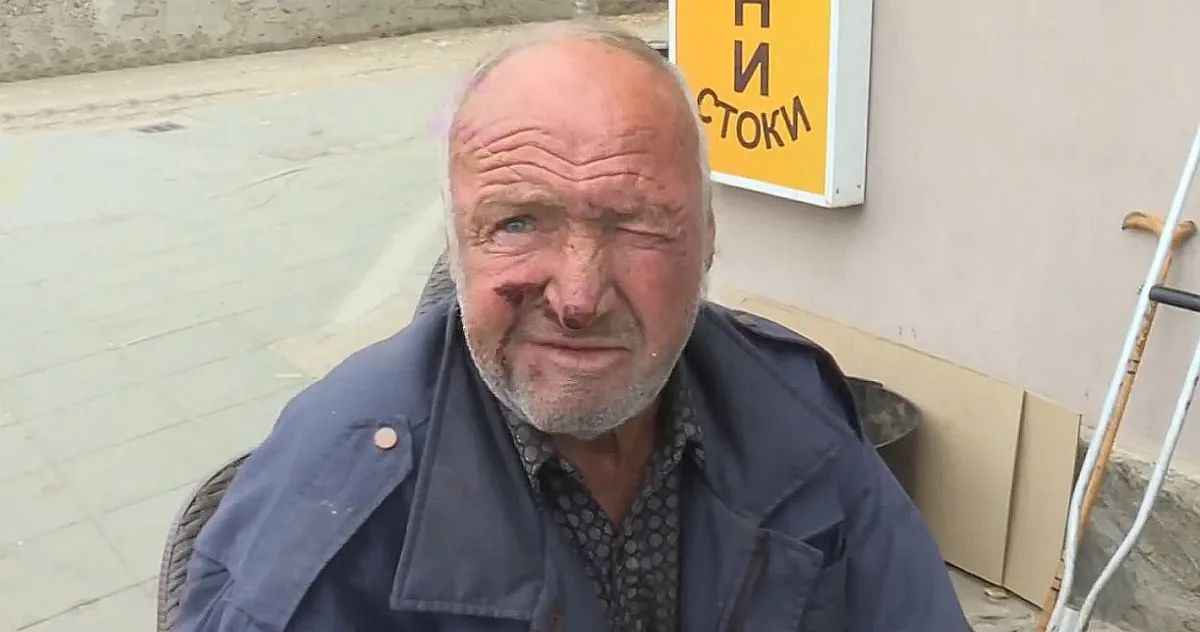 За кутия цигари! Изверги пребиха безпомощен пенсионер