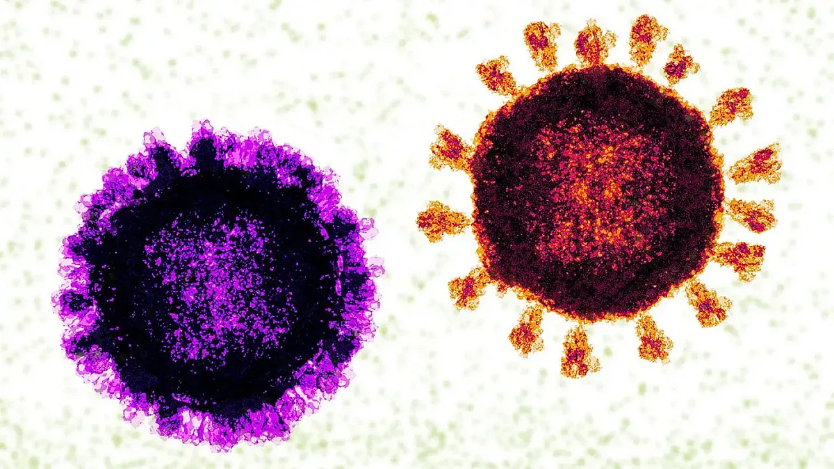 Този вирус убива най-много хора в света всяка година