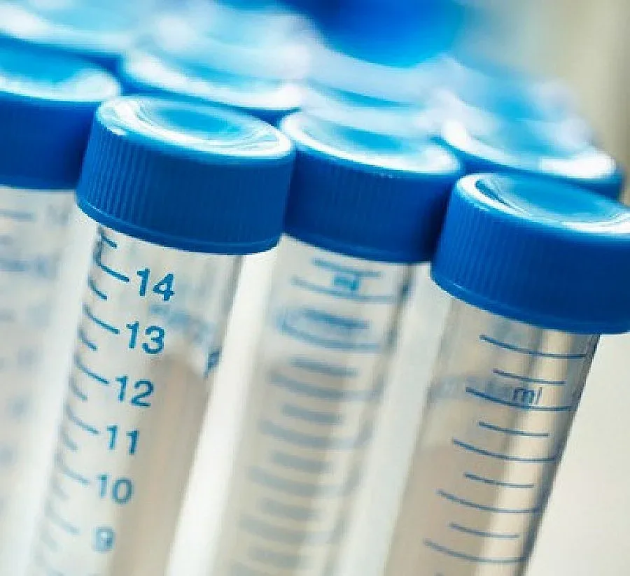 Само 60 се изследваха за опасна болест в Петрич