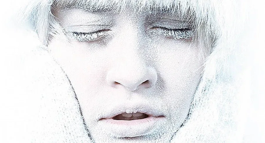 Студът буди псориазиса