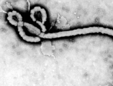 Медсестра си дава  кръвта срещу ебола