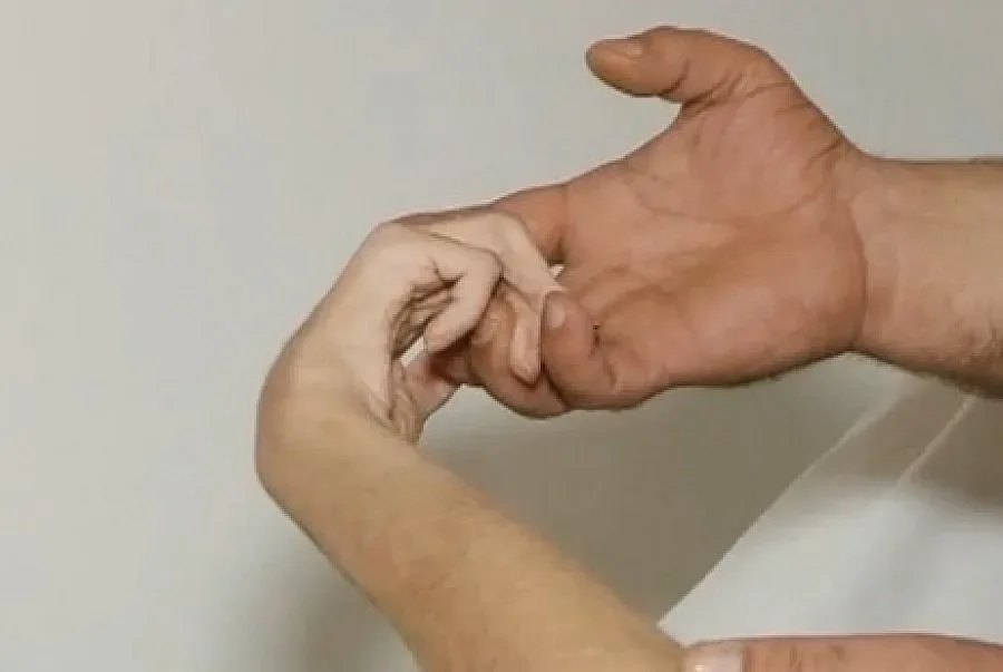 Абсурд с жена в будна кома в Пловдив