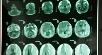 „Менса" иска да тества IQ-то на политиците