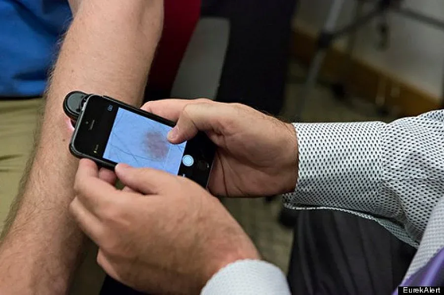 Приложение открива рак на кожата