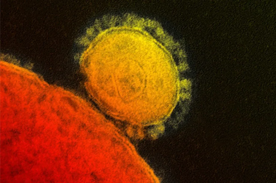 Саудитска Арабия обяви нови 13 жертви на коронавируса