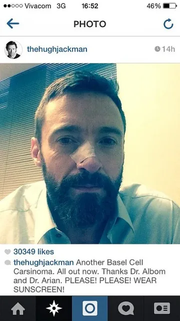 Хю Джакман пак се бори с рака