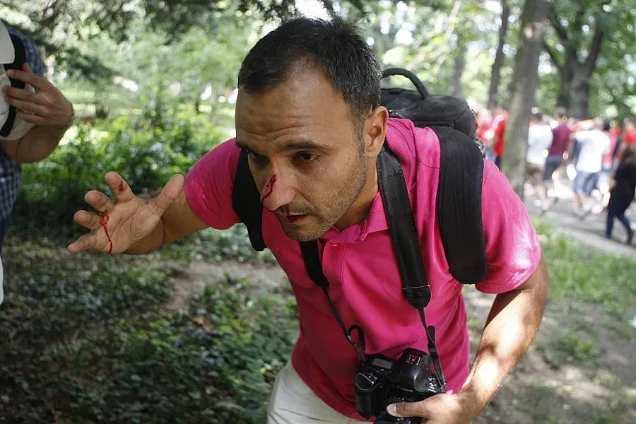 Съд за гамена, счупил носа на наш фотограф