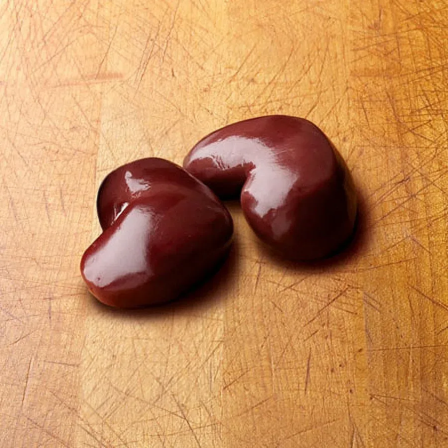 Съживяват бъбреци с плазмафереза