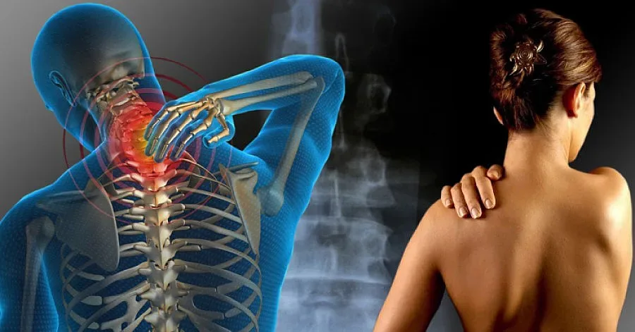 Необясними болки и умора - може би е фибромиалгия