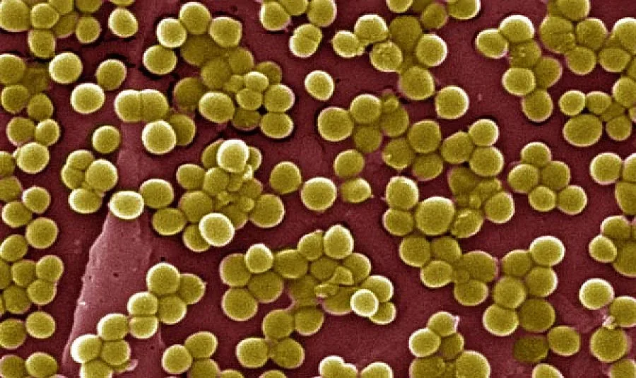 11 работници са носители на стафилокок в Сливен