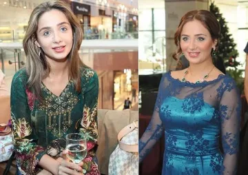 Елен Колева си махна бенката