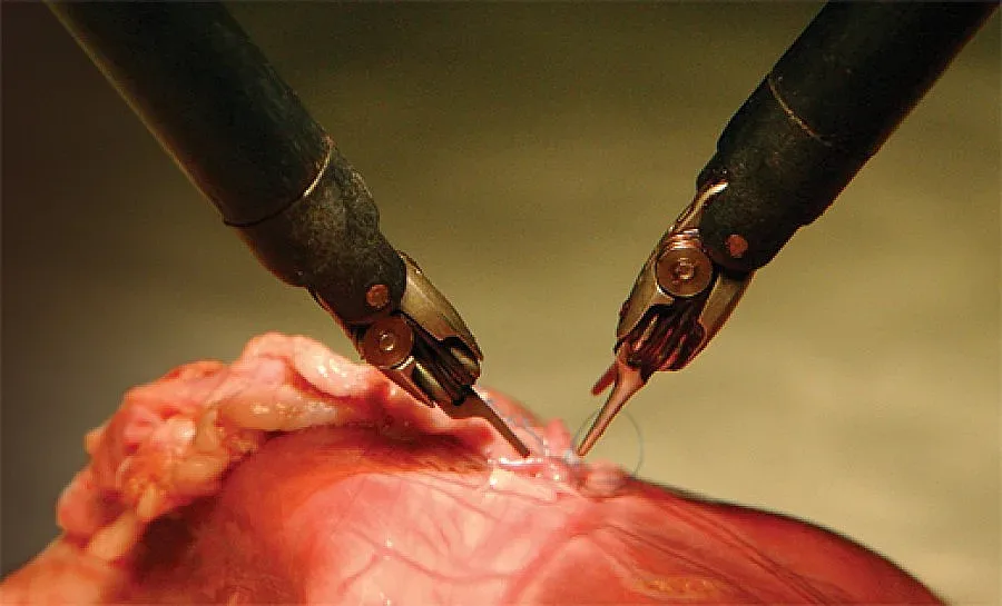 Махат рак през 1 см разрез